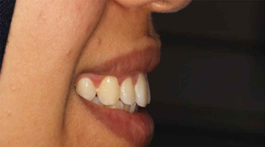 بعد تجميل وعلاج اللثة مركز دكتور ايمن الغمراوى لطب الاسنان 2